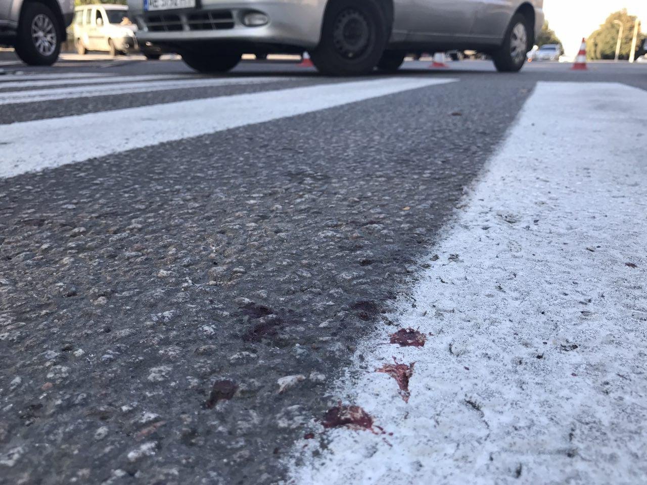 На Богдана Хмельницкого Lanos сбил женщину с ребенком на пешеходном переходе 6