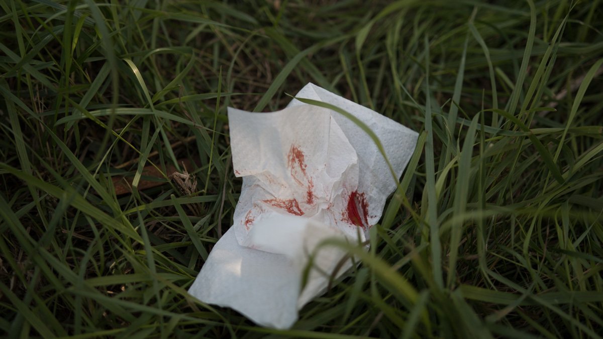 На Запорожском шоссе Daewoo Lanos вылетел на обочину: пострадал мужчина 4