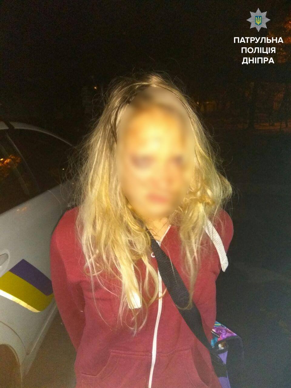 На Тополе задержали пьяную 21-летнюю девушку с кастетом 2