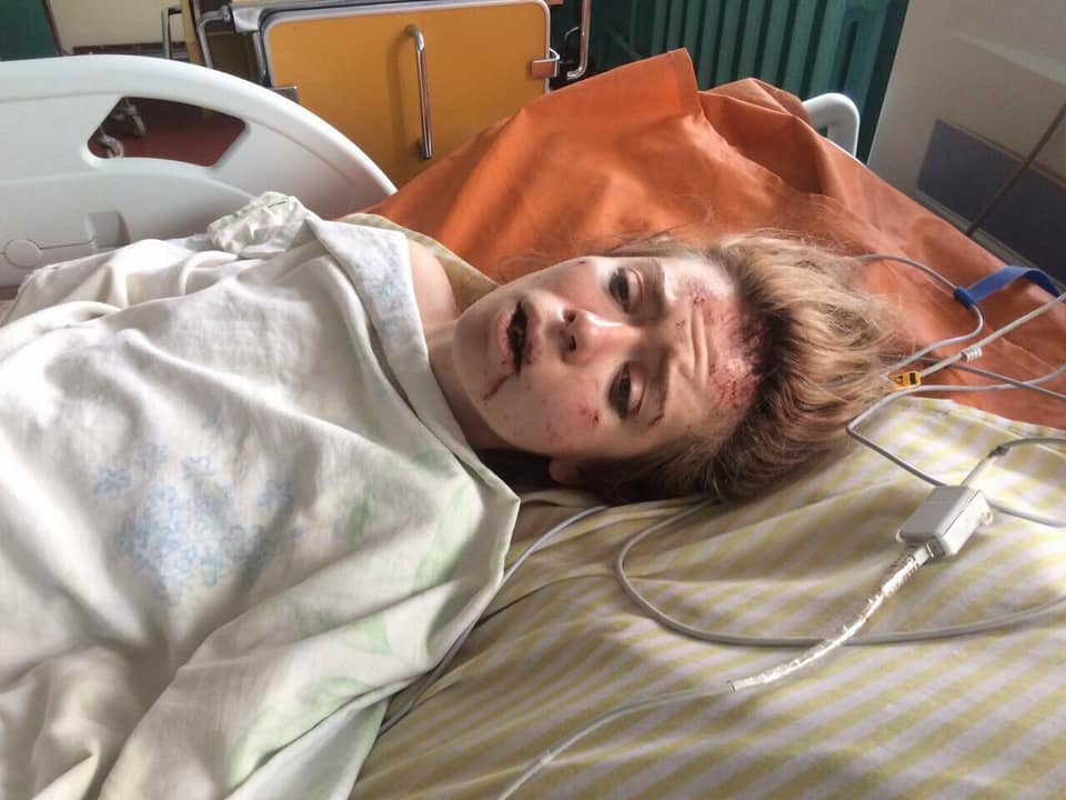 Пострадавшей в аварии под Житомиром жительнице Днепра нужна помощь 1