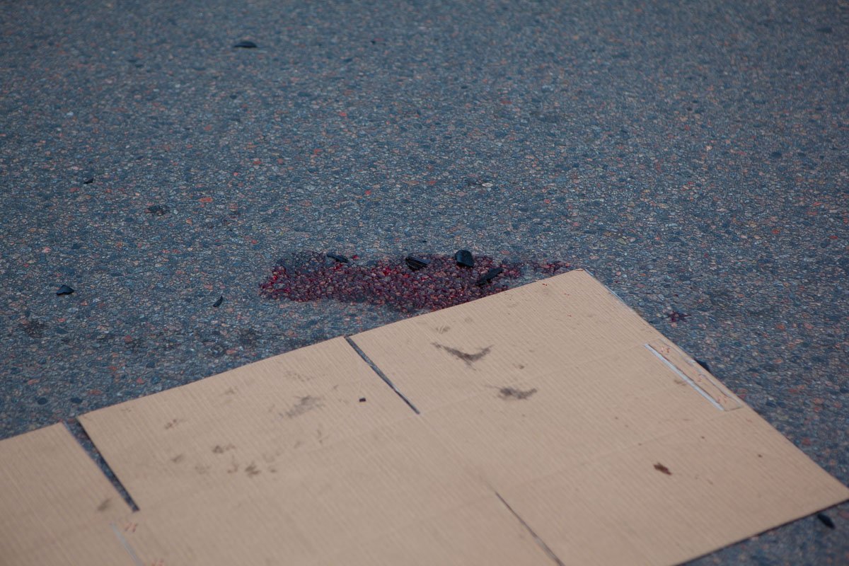 У потерпевшего диагностировали открытый перелом ноги У потерпевшего диагностировали открытый перелом ноги