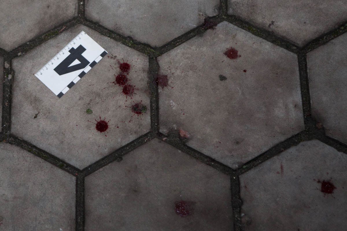 У стрелявшего, из-за драки, было сильно повреждено лицо