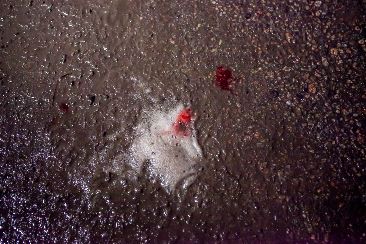 Сбитый пешеход получил травмы средней тяжести Сбитый пешеход получил травмы средней тяжести