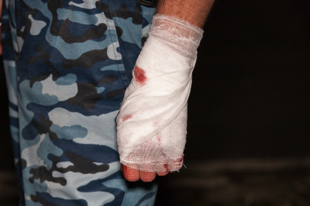 Неизвестный напал на сотрудника охранной службы и ранил его ножом Неизвестный напал на сотрудника охранной службы и ранил его ножом