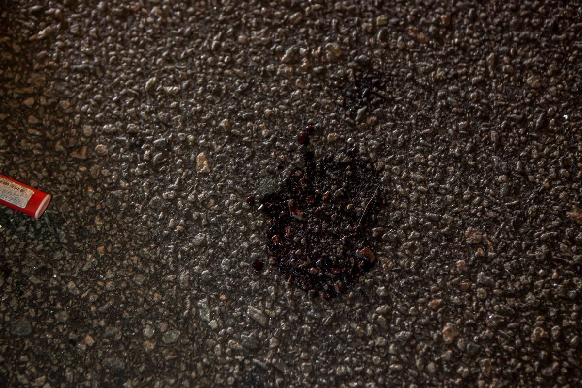 По словам медиков у потерпевшего перелом ноги, закрытая черепно-мозговая травма, вывих плеча и множество ссадин