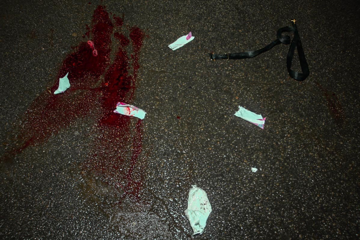 Пострадавшего с осколочным ранением ног госпитализировали в областную больницу имени Мечникова Пострадавшего с осколочным ранением ног госпитализировали в областную больницу имени Мечникова