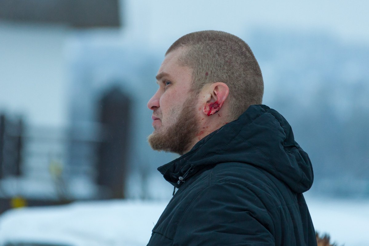 Помимо этого, в ходе конфликта с охранником прораб получил рваную рану уха Помимо этого, в ходе конфликта с охранником прораб получил рваную рану уха