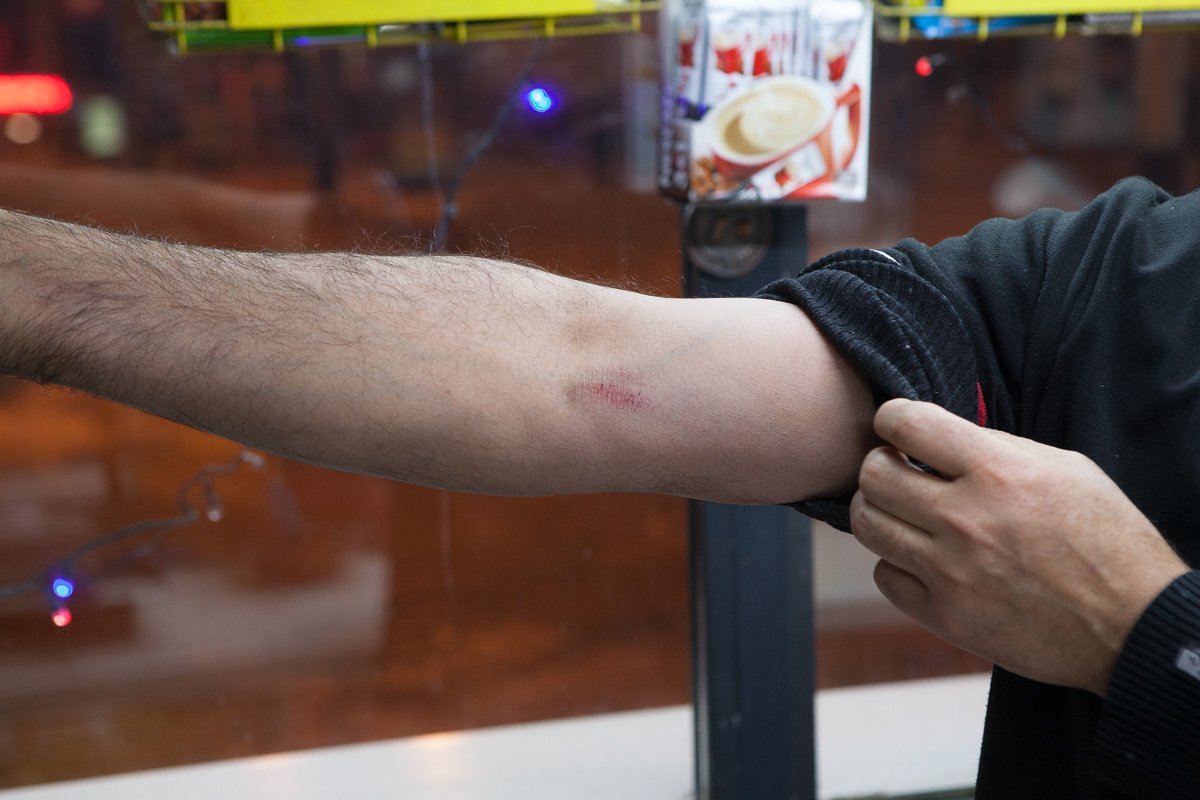 В подтверждение своих слов он продемонстрировал ссадины на лице и руках В подтверждение своих слов он продемонстрировал ссадины на лице и руках