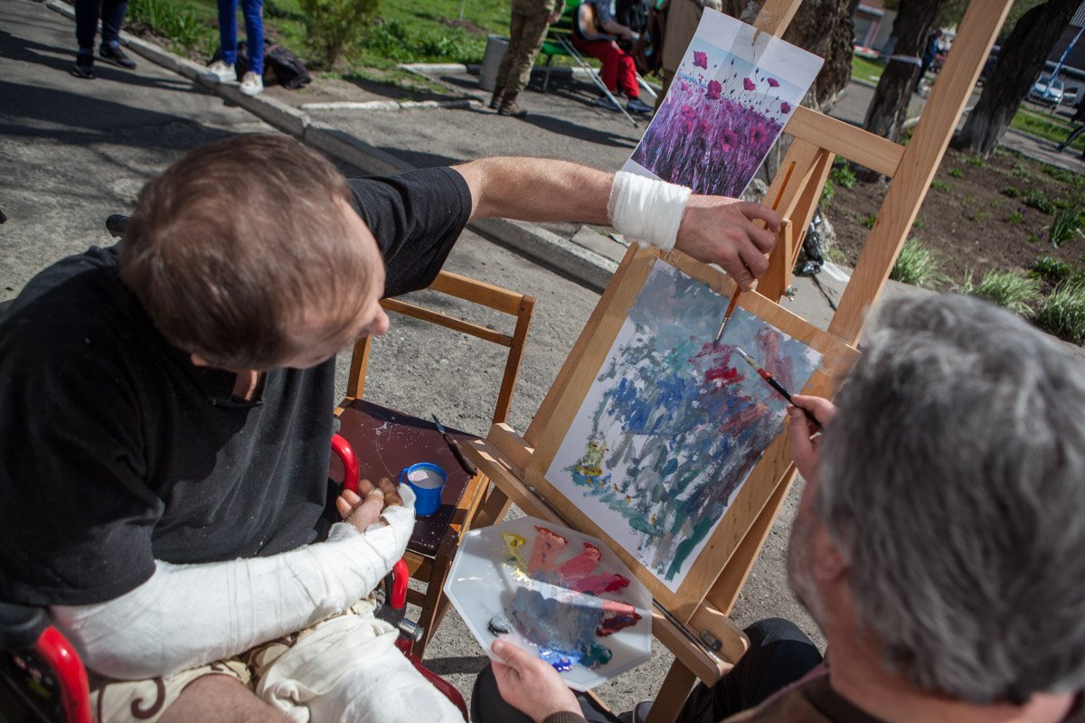 Гипс не повод бросить кисть