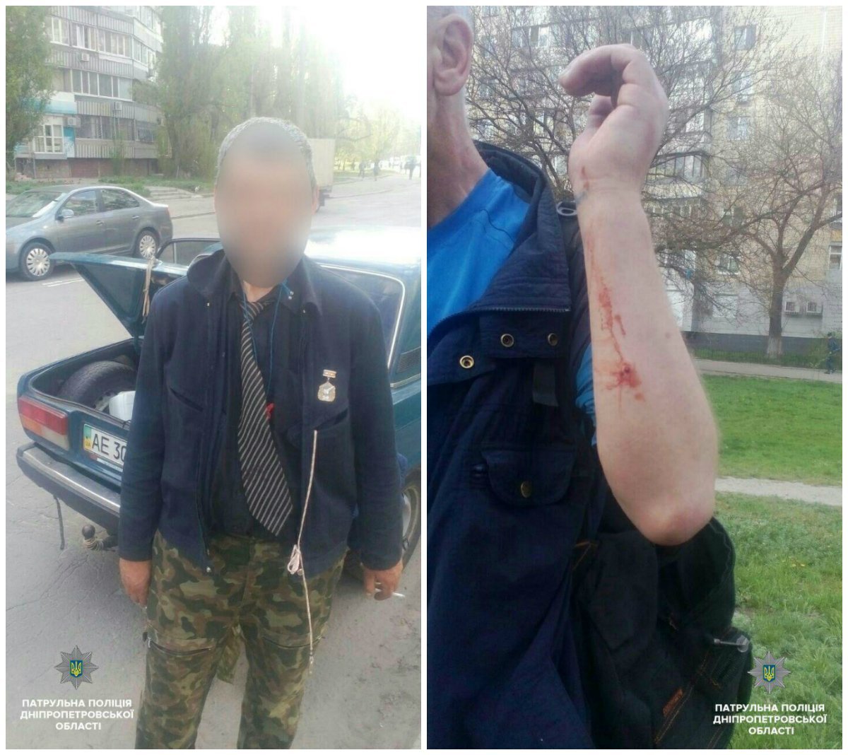 Злоумышленника, прострелившему мужчине руку и ногу, вскоре задержали полицейские Злоумышленника, прострелившему мужчине руку и ногу, вскоре задержали полицейские