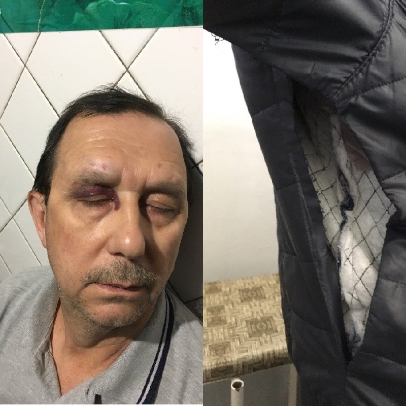 Поступая по совести, Олег получил травмы Поступая по совести, Олег получил травмы