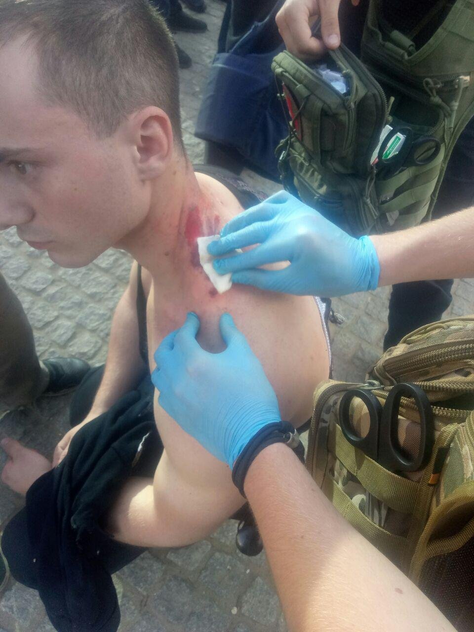 В центре Днепра во время марша ультрас патрульному забросили петарду под жилет