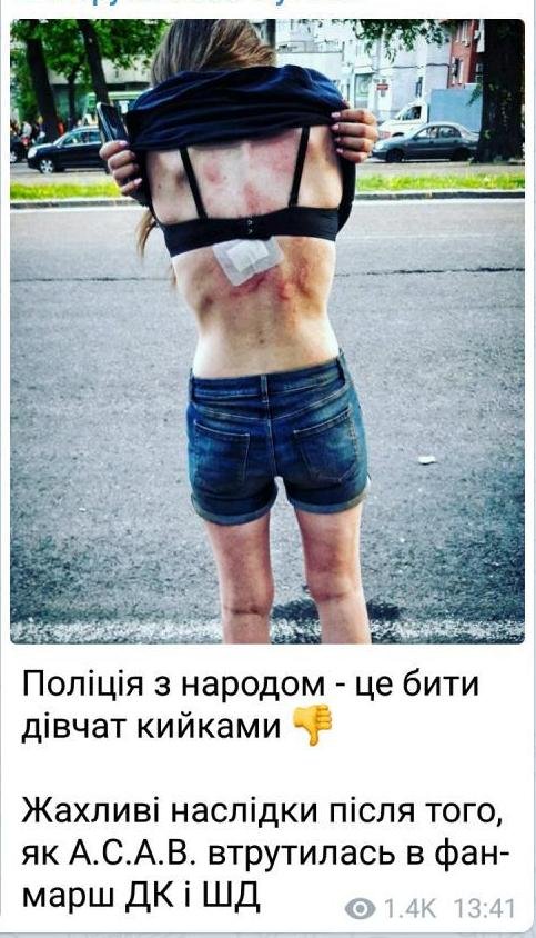 В сети распространяется информация о пострадавшей от рук правоохранителей девушки, которую ни за что дубинками избили полицейские