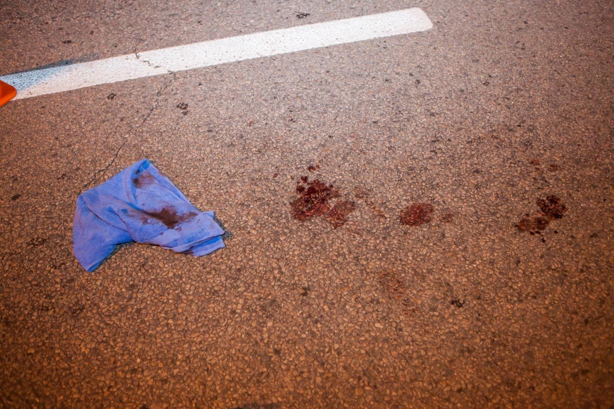 На дороге остались следы крови пострадавшего 