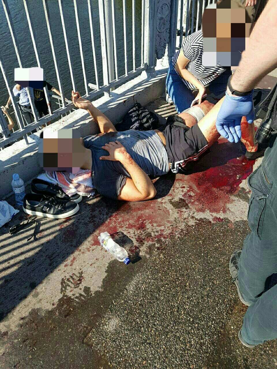 Мужчине оказали первую медицинскую помощь Мужчине оказали первую медицинскую помощь