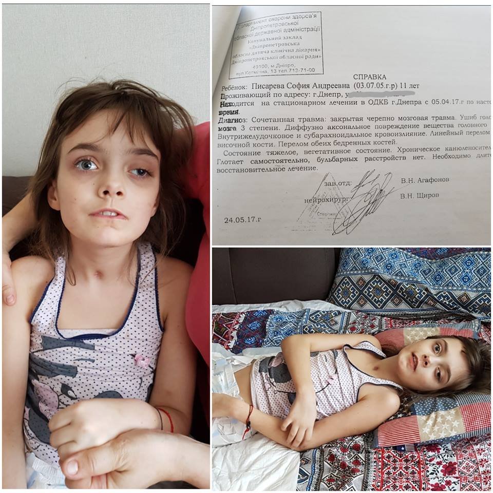 Обе девочки получили инвалидность Обе девочки получили инвалидность