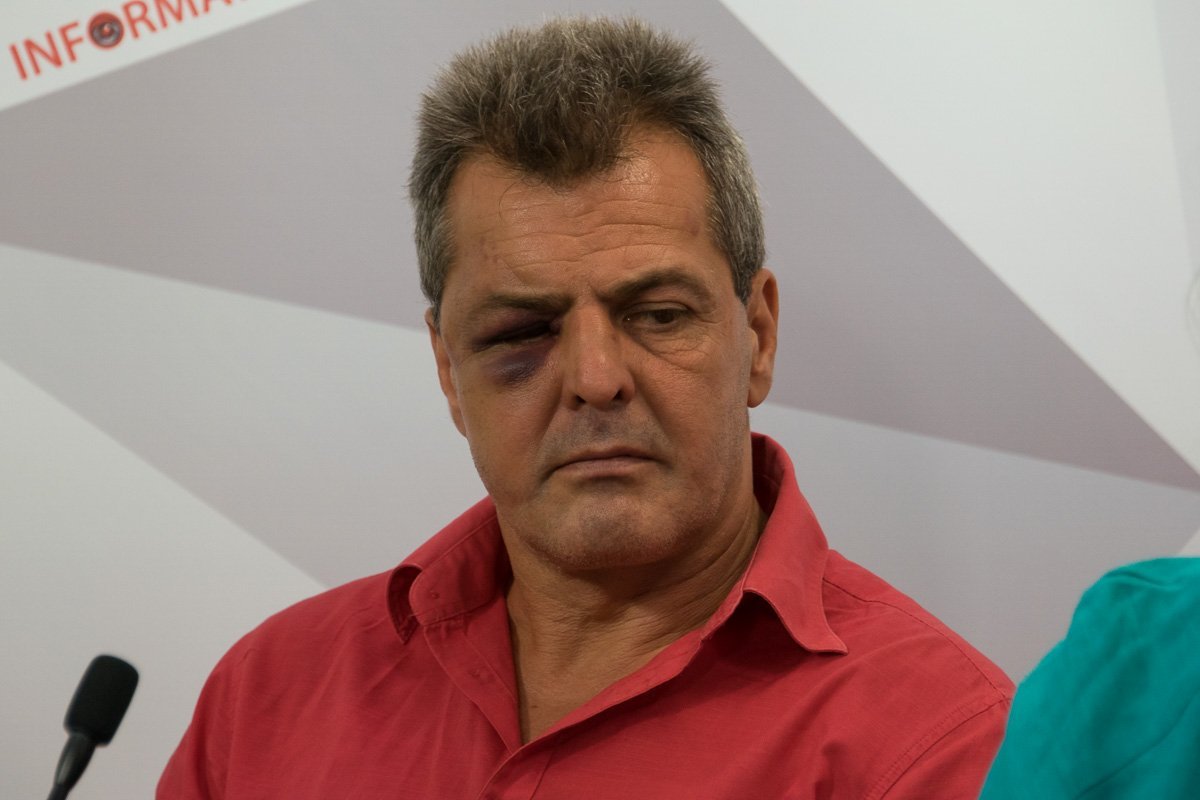 Пострадавший в драке Николай Захаров Пострадавший в драке Николай Захаров