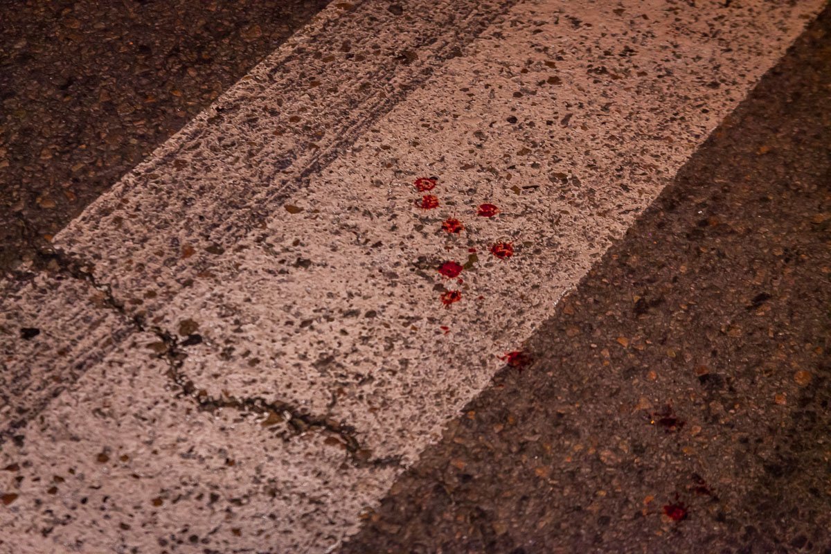 Пострадавшего госпитализировали в областную клиническую больницу имени Мечникова