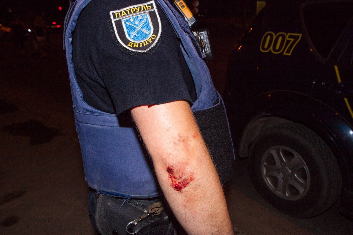 Ссадины и порезы остались у многих полицейских