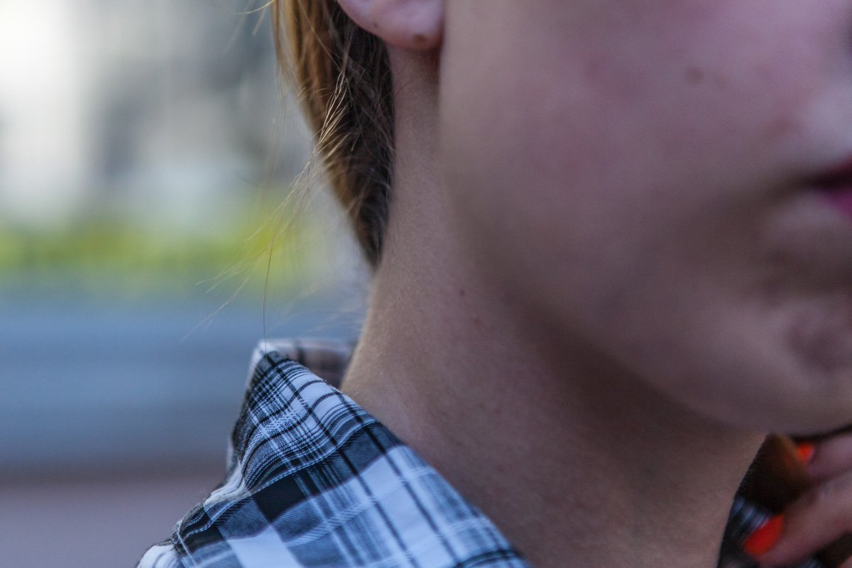 Покраснения от насилия