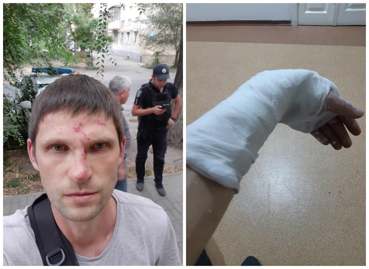 У мужчины ссадины на лице и сломана рука