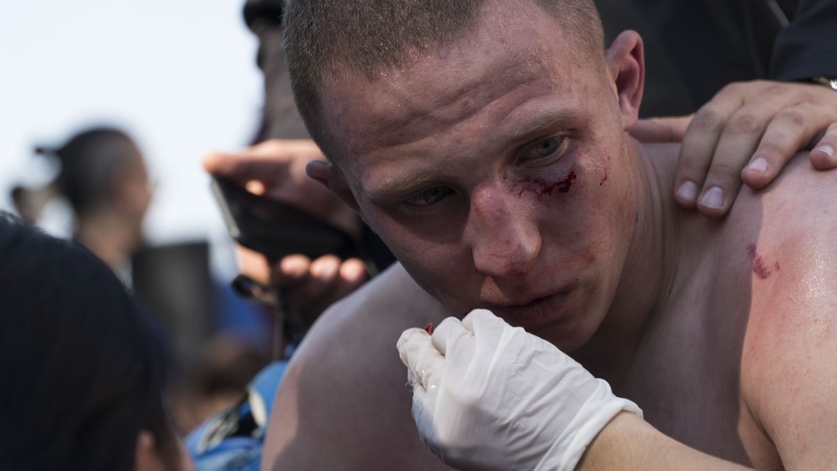 Некоторые участники получили травмы