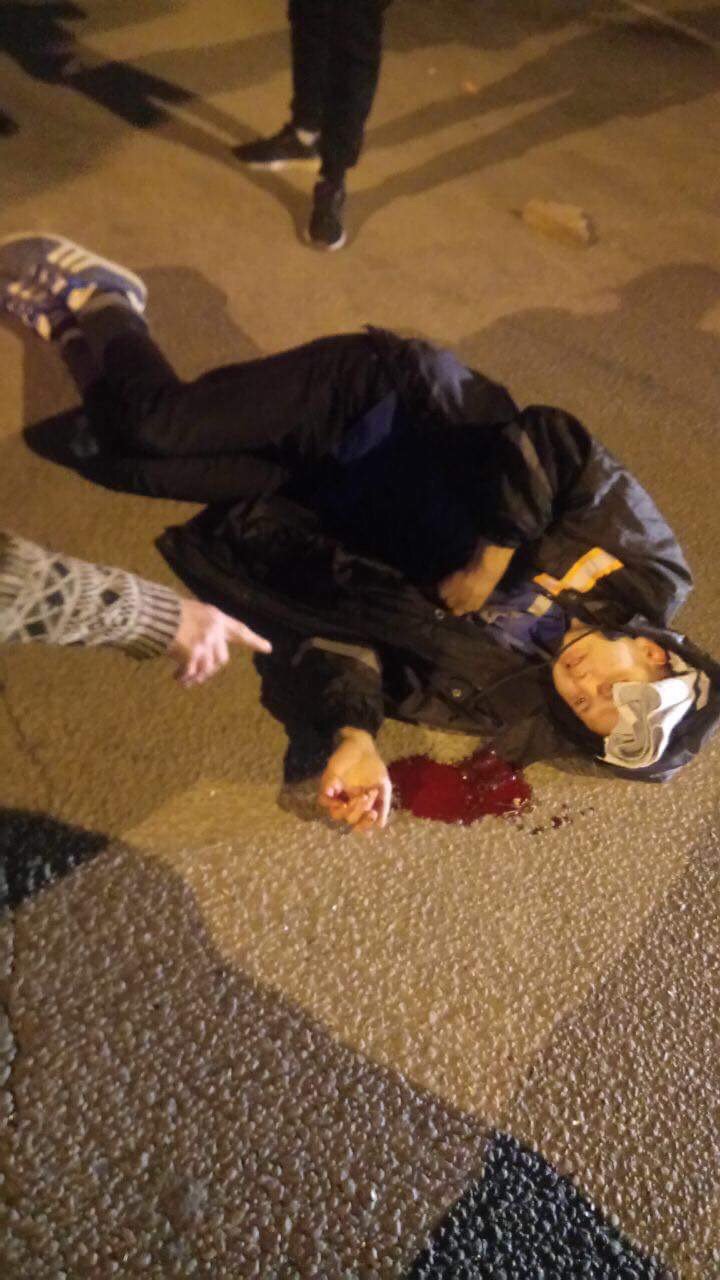 Пострадавшего медики госпитализировали в 16-ю больницу Пострадавшего медики госпитализировали в 16-ю больницу