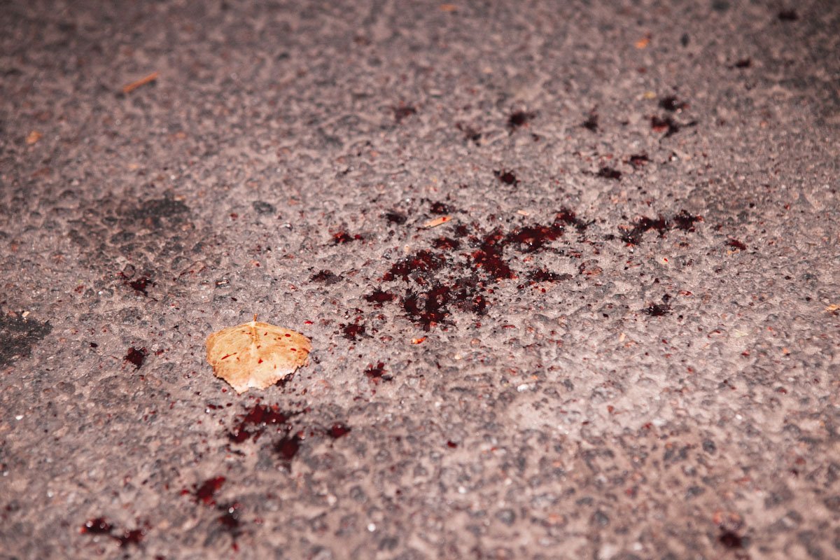 Ранили в руку