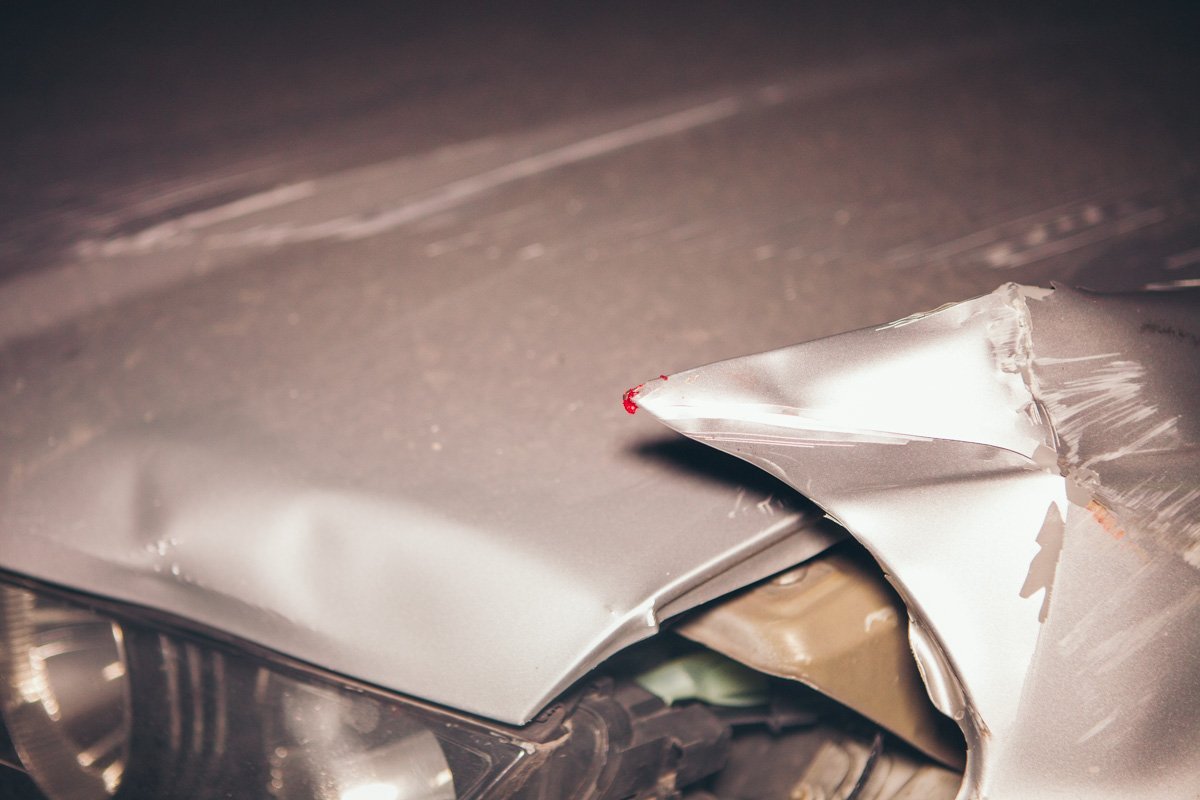 Состояние пострадавшего крайне тяжелое