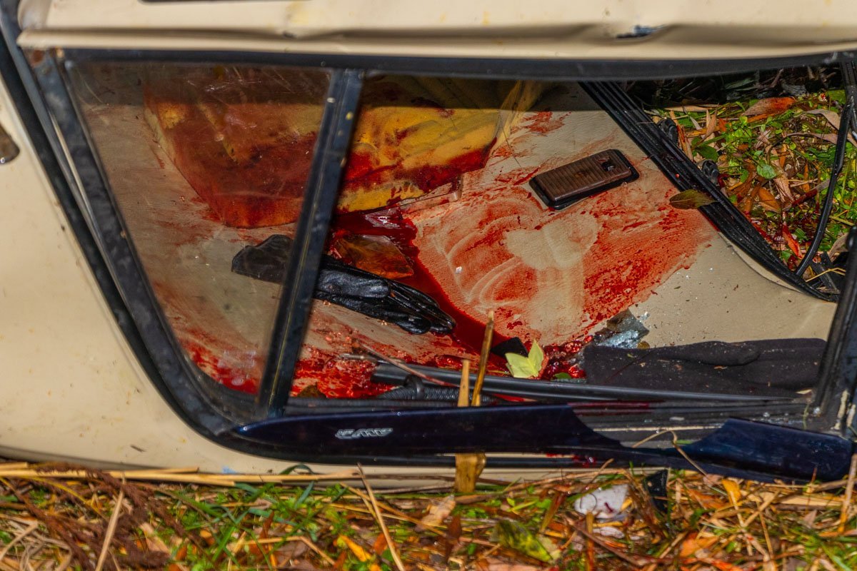 Пострадавшего забрала скорая, предварительно, с переломом ноги, травмы живота и головы