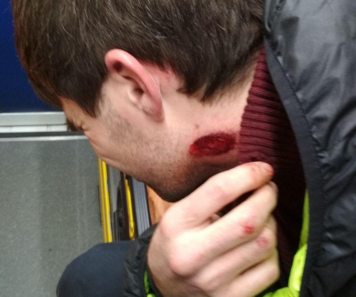 В Днепре на Набережной Победы стреляли в мужчину 2