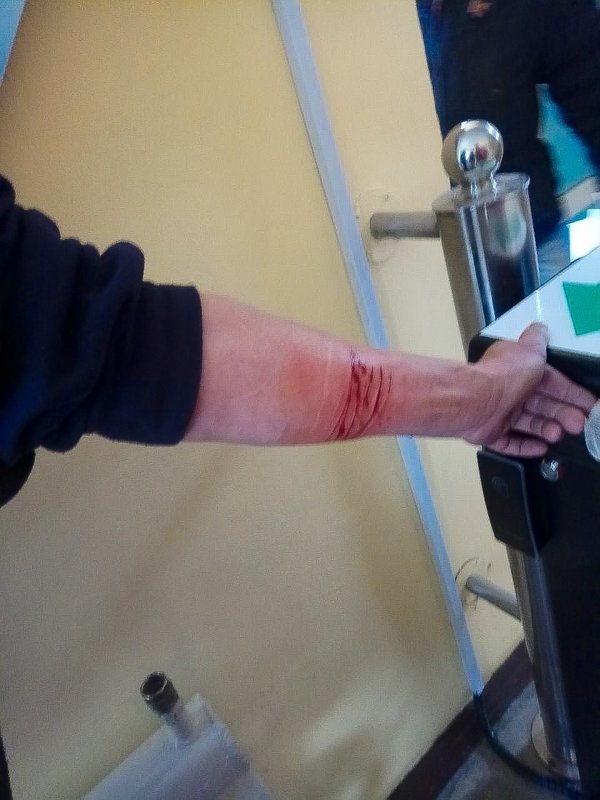 В Днепре мужчина пытался покончить жизнь самоубийством в знак протеста руководству В Днепре мужчина пытался покончить жизнь самоубийством в знак протеста руководству