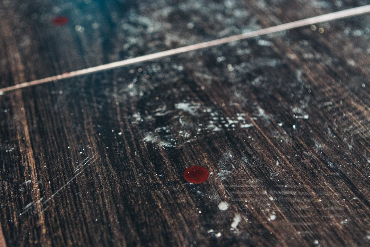 У хозяина квартиры травма кисти и порезы на лице У хозяина квартиры травма кисти и порезы на лице