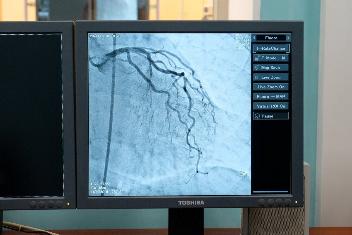 Один из аппаратов выделили исключительно под экстренную помощь при инфарктах