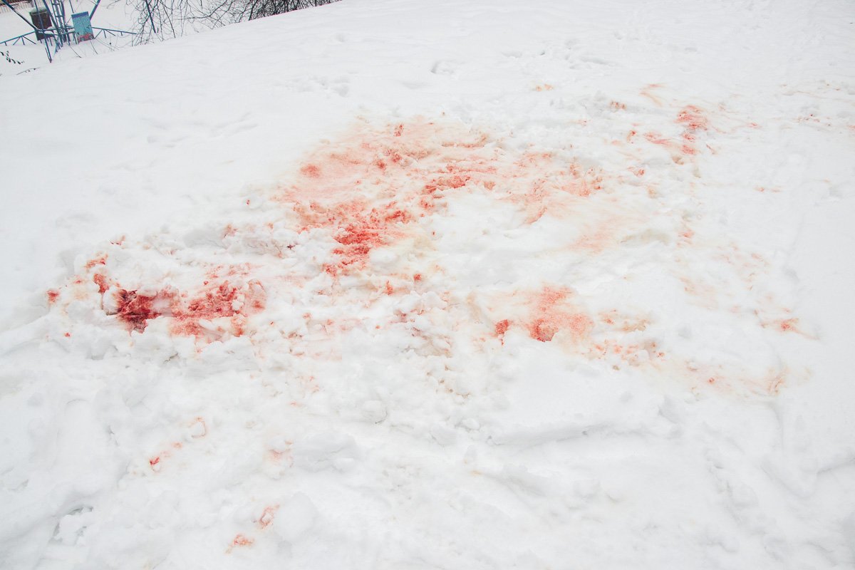 Медики оказывают помощь пострадавшему и сейчас его жизни ничего не угрожает Медики оказывают помощь пострадавшему и сейчас его жизни ничего не угрожает