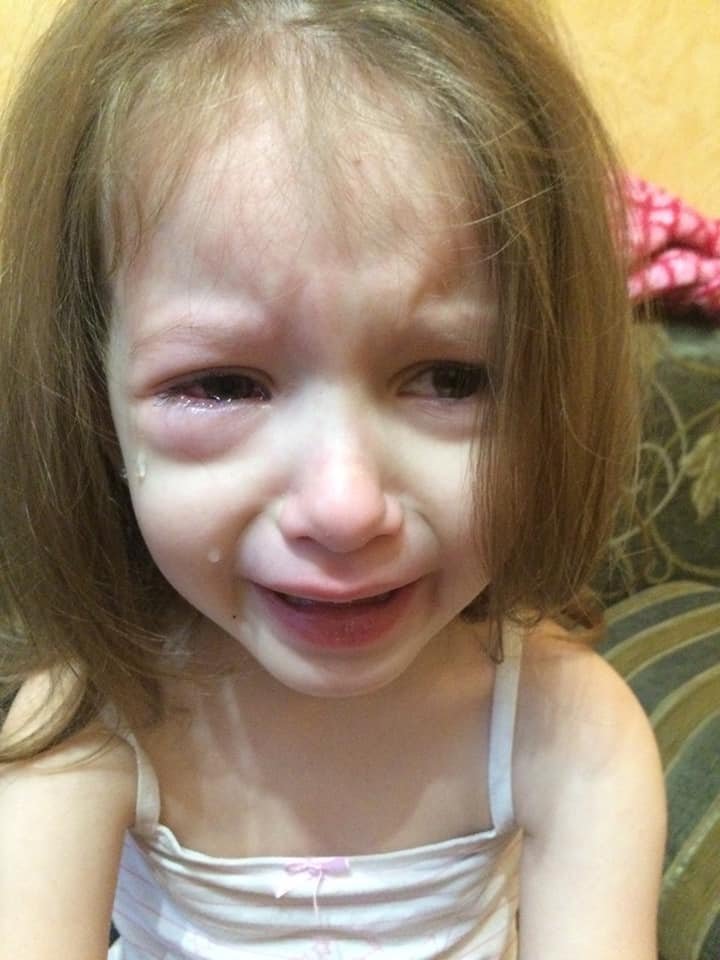 Кусочек графита застрял в нижнем веке Кусочек графита застрял в нижнем веке