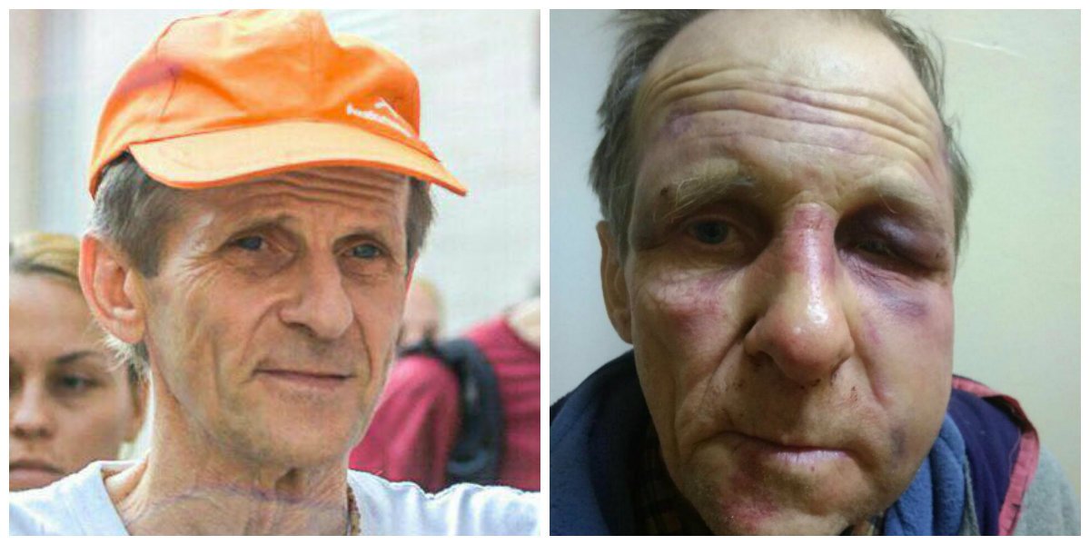 В Днепре жестоко избили пожилого мужчину: помогите найти свидетелей 1