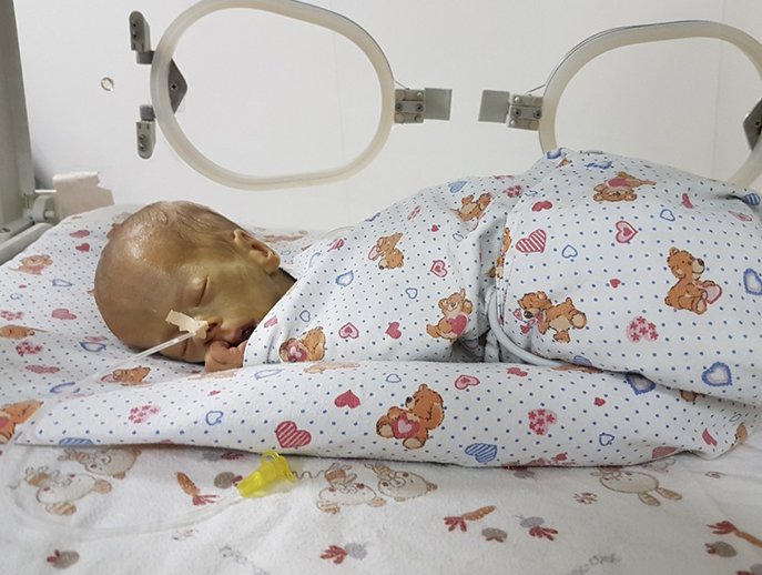 Уже третий месяц малышка в реанимации, борется за каждый свой новый день Уже третий месяц малышка в реанимации, борется за каждый свой новый день