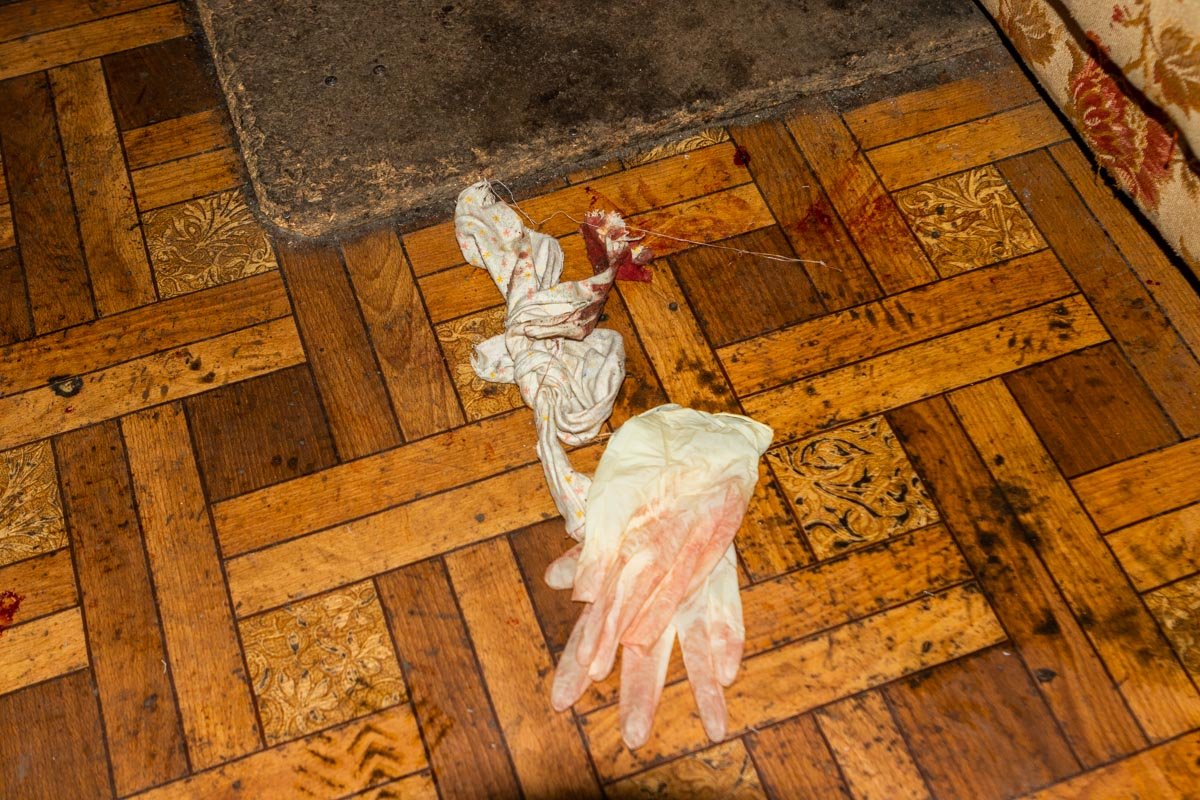 Пуля попала мужчине в ногу Пуля попала мужчине в ногу