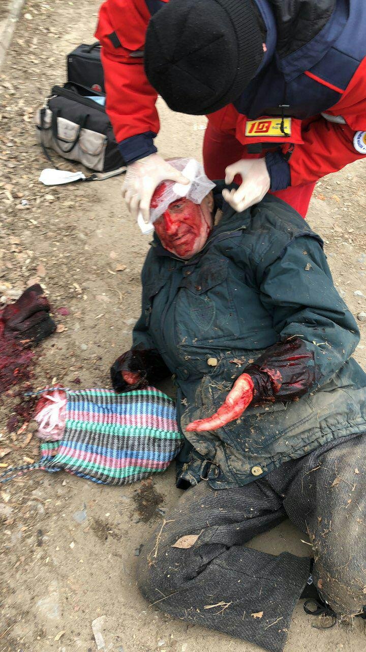 В Днепре мужчина упал и разбил себе голову: очевидец чуть не избил врача В Днепре мужчина упал и разбил себе голову: очевидец чуть не избил врача