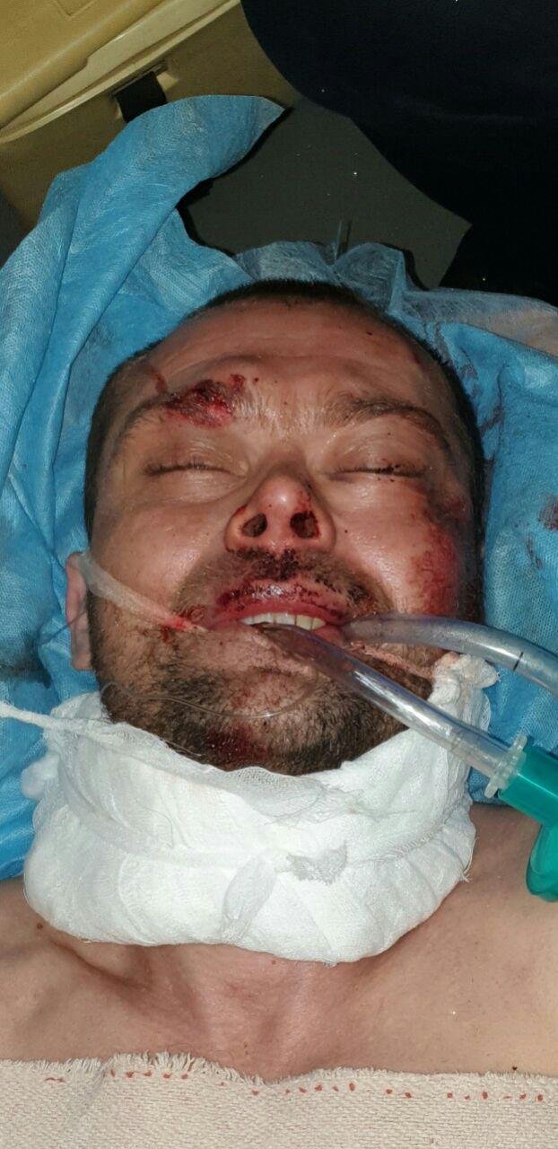 В больнице в Днепре скончался мужчина, которого сбил автомобиль: помогите опознать