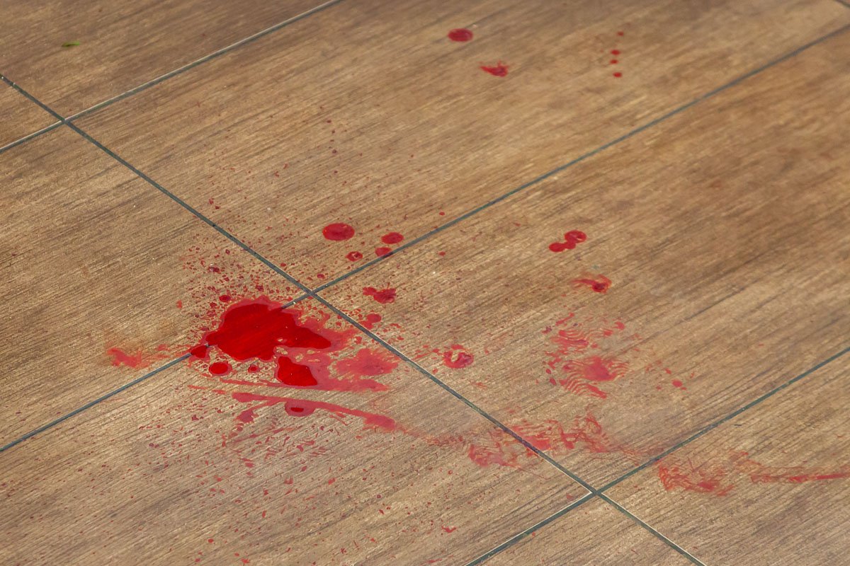 Один из парней утверждал, что его побили