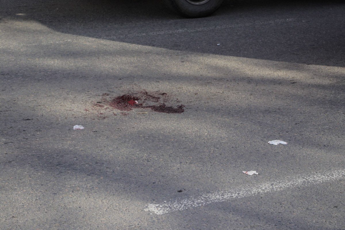 С места аварии пострадавшую госпитализировали 16-ю городскую больницу С места аварии пострадавшую госпитализировали 16-ю городскую больницу