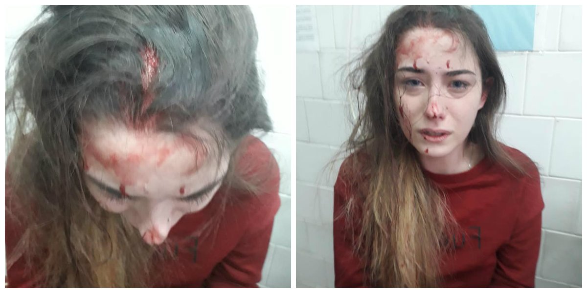 Лизе 16 лет Лизе 16 лет