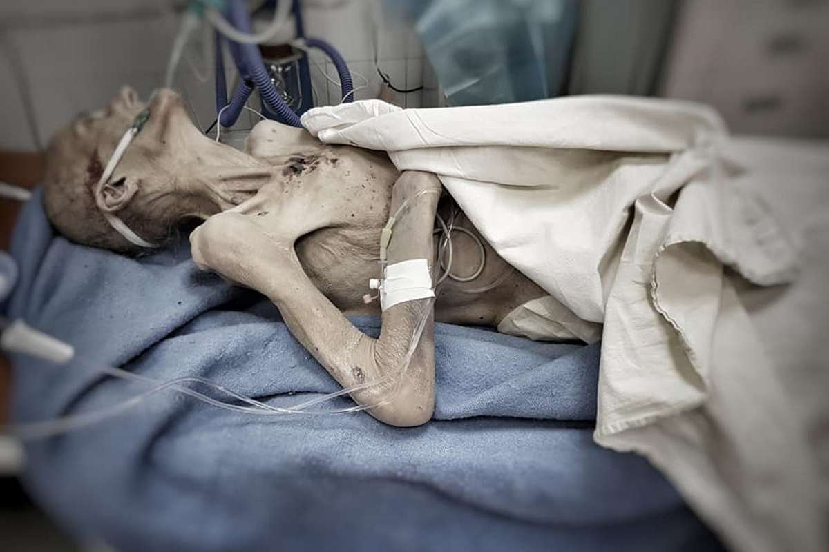 То состояние, в котором женщину увидели медики, сложно назвать живым