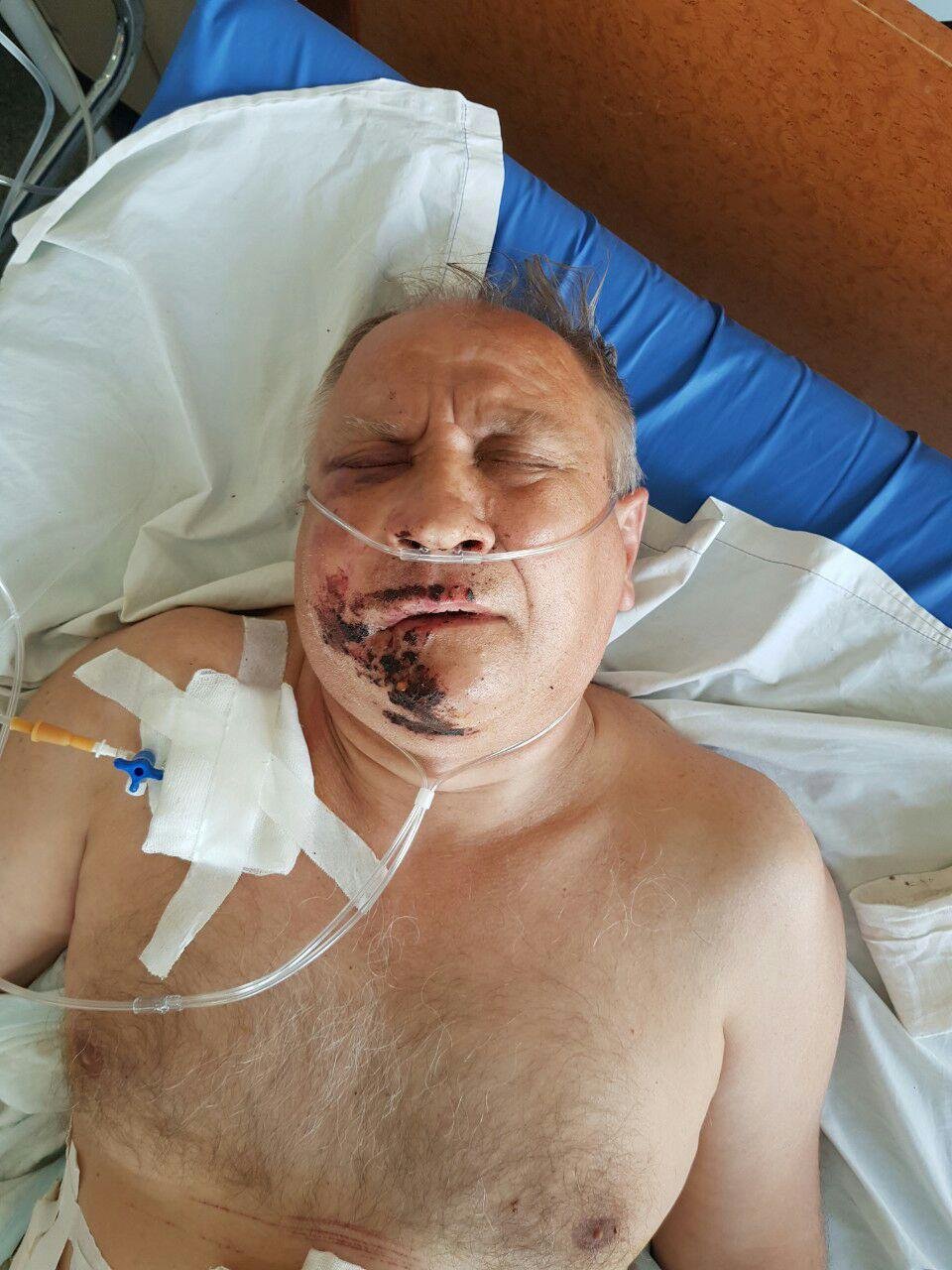 В Днепре на Аэропортовской ВАЗ сбил мужчину: помогите опознать пострадавшего В Днепре на Аэропортовской ВАЗ сбил мужчину: помогите опознать пострадавшего