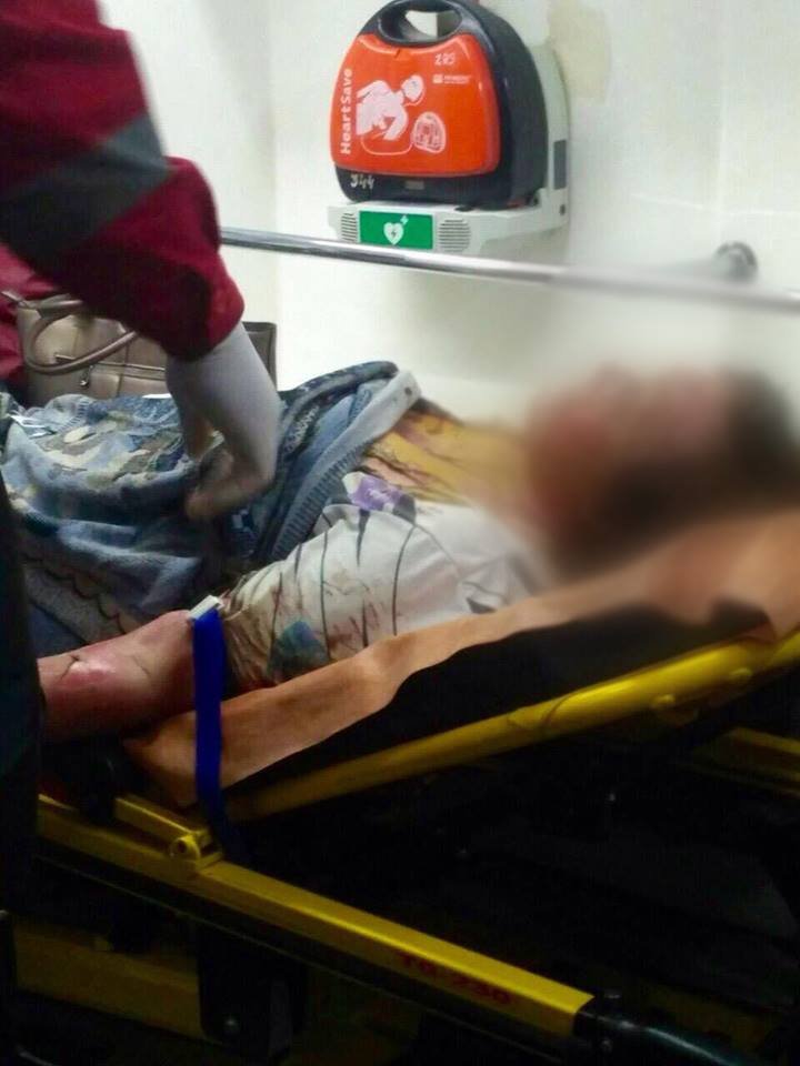 Пострадавшую женщину доставили в больницу №2