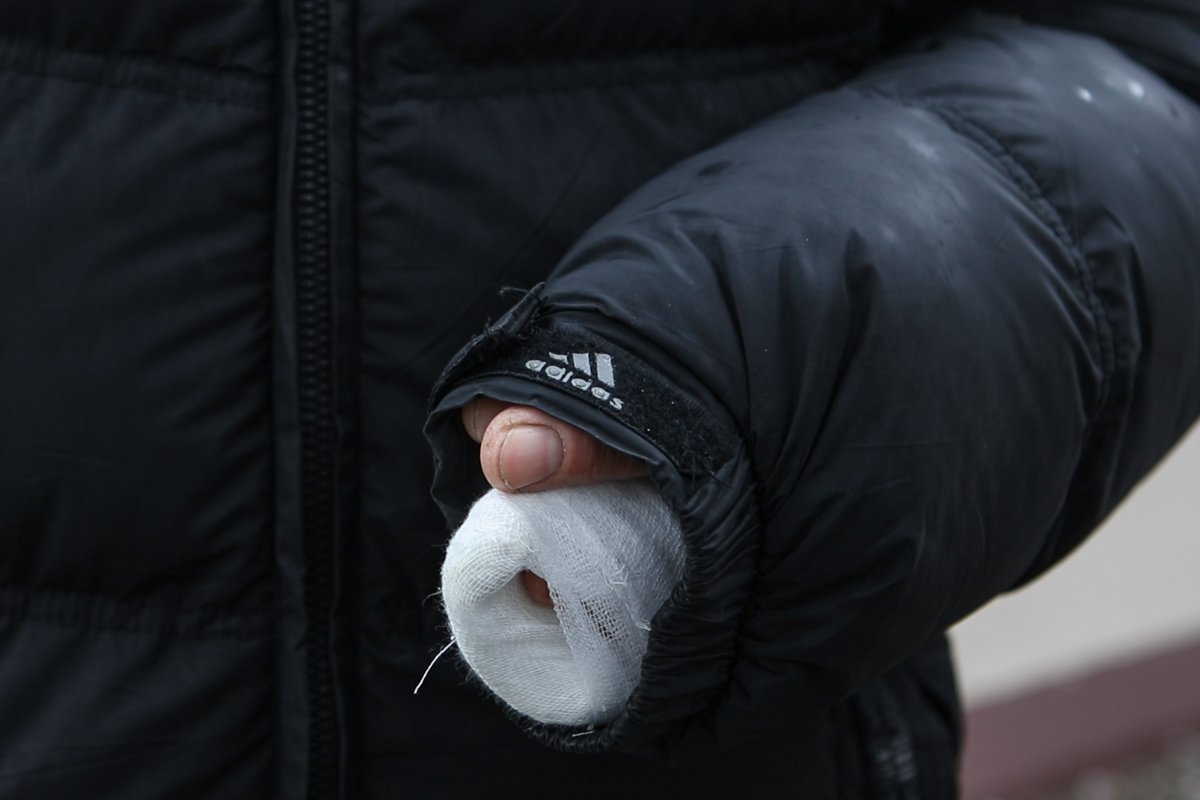 Вернулся из больницы мужчина уже с гипсом на руке Вернулся из больницы мужчина уже с гипсом на руке