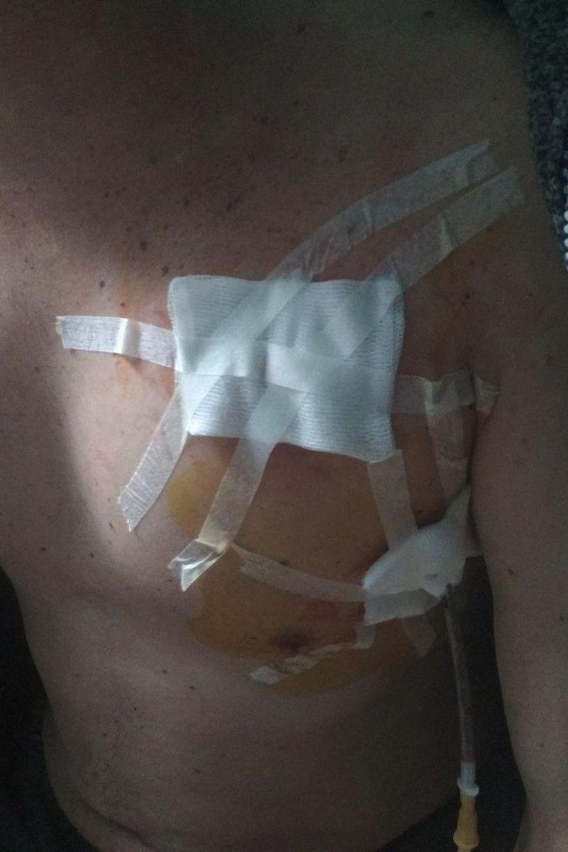 Все обошлось - мужчина остался жив и находится под присмотром медиков