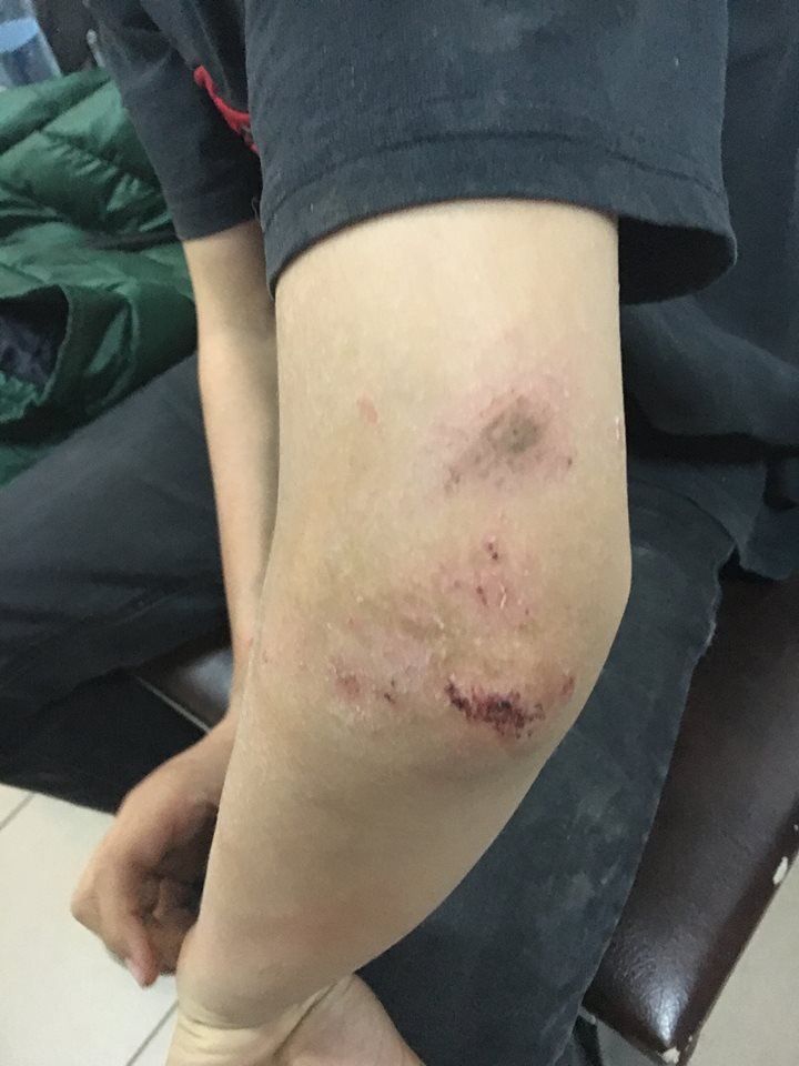 Мальчик чувствует себя хорошо Мальчик чувствует себя хорошо